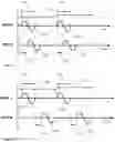 Fig. 41 - Methods and devices for aesthetic treatment of biological structures by radiofrequency and magnetic energy