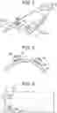 Fig. 02 - Transorbital NIR light therapy device