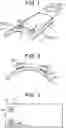 Fig. 02 - Transorbital NIR LIGHT THERAPY DEVICES