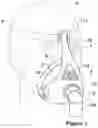 Fig. 02 - Patient interface and a speech valve therefor