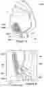 Fig. 09 - Patient interface and a speech valve therefor