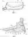Fig. 04 - Golf club head