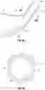 Fig. 06 - Golf club head