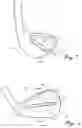Fig. 02 - Golf club heads with insert and related methods