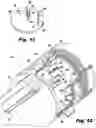 Fig. 08 - Filter cartridge assembly having fluid management structure