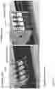 Fig. 34 - Fluorescence detector for microfluidic diagnostic system