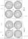 Fig. 10 - Bottom electrode via structures for micromachined ultrasonic transducer devices