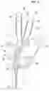 Fig. 06 - Wearable hand robot