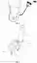 Fig. 04 - RELEASE AGENT SUPPLY DEVICE FOR COLD KNIFE WEAKENING AND A COLD KNIFE SYSTEM COMPRISING SUCH A DEVICE