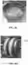 Fig. 08 - Non-pneumatic tire having block type reinforcement