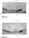 Fig. 07 - Vehicle hitch ball detection system