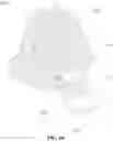 Fig. 11 - BABY CARRIAGE HAVING IMPROVED CONVENIENCE OF USE
