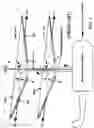 Fig. 02 - Negative hinge offset rotor head for a helicopter