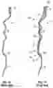 Fig. 04 - Childproof tamper evident closure assembly