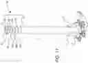 Fig. 12 - Jib crane with tension frame and compression support