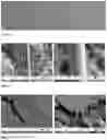 Fig. 06 - Method for producing a condensed adhesive phase of silk fusion proteins