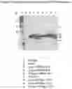 Fig. 09 - Modification and Compositions of Human Secretoglobin Proteins