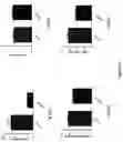 Fig. 19 - METHOD OF TREATING OR AMELIORATING METABOLIC DISORDERS USING GROWTH DIFFERENTIATION FACTOR 15 (GDF-15)