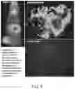 Fig. 07 - Vesicular stomatitis viruses