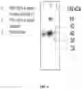 Fig. 07 - COMPOSITIONS AND METHODS OF USE FOR DETERMINATION OF HE4a