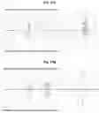 Fig. 10 - THYMIC STROMAL LYMPHOPOIETIN (TSLP)-BINDING MOLECULES AND METHODS OF USING THE MOLECULES