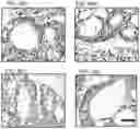 Fig. 41 - Cancer stem cell-specific molecule