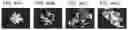 Fig. 46 - Cancer stem cell-specific molecule