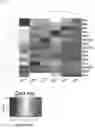 Fig. 03 - Bioengineered in vitro 3D model of human atherosclerotic plaque