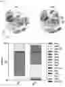 Fig. 05 - Bioengineered in vitro 3D model of human atherosclerotic plaque