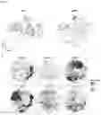 Fig. 06 - Bioengineered in vitro 3D model of human atherosclerotic plaque