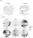Fig. 09 - Bioengineered in vitro 3D model of human atherosclerotic plaque