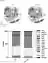 Fig. 11 - Bioengineered in vitro 3D model of human atherosclerotic plaque