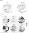 Fig. 12 - Bioengineered in vitro 3D model of human atherosclerotic plaque