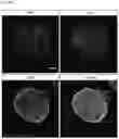 Fig. 16 - Bioengineered in vitro 3D model of human atherosclerotic plaque