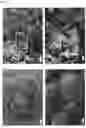 Fig. 20 - Bioengineered in vitro 3D model of human atherosclerotic plaque