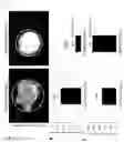 Fig. 03 - Method for freezing aggregates of pluripotent stem cell-derived cardiomyocytes