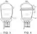 Fig. 04 - System and method for extraction and cryopreservation of bone marrow