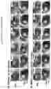 Fig. 20 - Processes for making and using a mesenchymal stem cell derived secretome