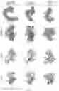 Fig. 102 - RNA-GUIDED DNA INTEGRATION USING TN7-LIKE TRANSPOSONS
