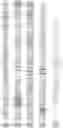 Fig. 114 - RNA-GUIDED DNA INTEGRATION USING TN7-LIKE TRANSPOSONS