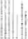 Fig. 115 - RNA-GUIDED DNA INTEGRATION USING TN7-LIKE TRANSPOSONS