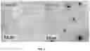 Fig. 04 - Aptamers as a therapeutic tool to prevent protein aggregation in neurodegenerative disease