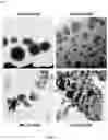 Fig. 08 - Aptamers as a therapeutic tool to prevent protein aggregation in neurodegenerative disease