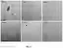Fig. 12 - Aptamers as a therapeutic tool to prevent protein aggregation in neurodegenerative disease