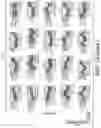 Fig. 41 - PARP9 and PARP14 as key regulators of macrophage activation