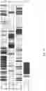 Fig. 04 - A COMBINATIONAL STRATEGY FOR REDUCING RANDOM INTEGRATION EVENTS WHEN TRANSFECTING PLANTS