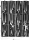 Fig. 10 - A COMBINATIONAL STRATEGY FOR REDUCING RANDOM INTEGRATION EVENTS WHEN TRANSFECTING PLANTS
