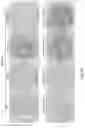 Fig. 11 - A COMBINATIONAL STRATEGY FOR REDUCING RANDOM INTEGRATION EVENTS WHEN TRANSFECTING PLANTS