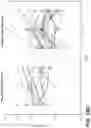 Fig. 41 - Methods for diagnosing and treating inflammatory bowel disease