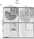 Fig. 56 - CANCER BIOMARKERS AND METHODS OF USE